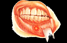 Pacienți - clinică dentară cu ferrostom g