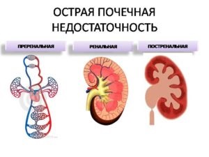 În mod constant vreau să dorm și cauze puternice de oboseală