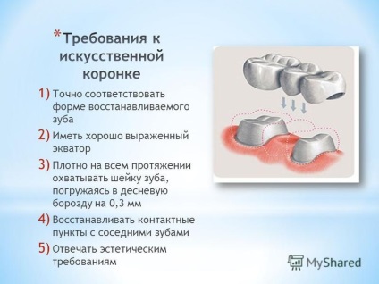 Презентація на тему пластмасові коронки