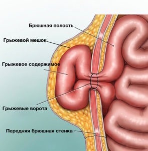 Tratamentul herniei ombilicale, intervenția chirurgicală pentru îndepărtarea - prețurile la Rostov-pe-Don, Burikov Maxim Alekseevich