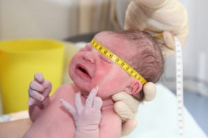 Dimensiunea normei capului nou-născutului și abaterea