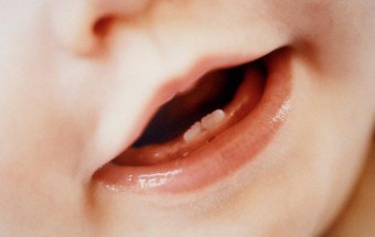 Vărsăturile la dentiție la copii sunt un fenomen natural sau un simptom amenințător