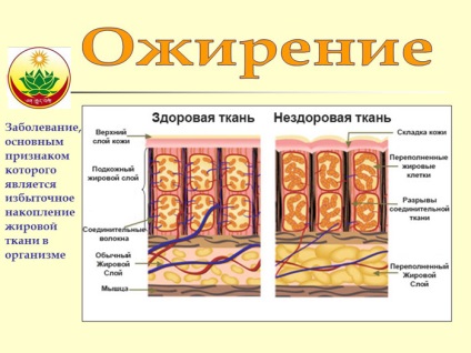 Medicina tibetană împotriva obezității