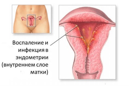 Descărcarea după naștere cât de multe ultime, normale, semne de patologie, prevenirea complicațiilor