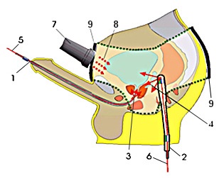 Yarilo - sync 02 urológiai eszköz, az ár 118 000 r