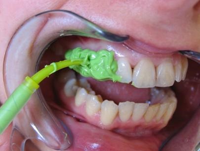 Laborator stomatologic - maestru dentar - 5