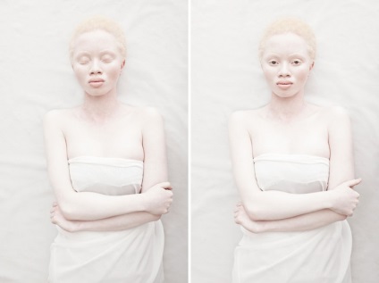 20 de oameni albini uciși, izbitoare de aspectul lor, umkra