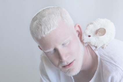 20 Szomorú albínó emberek, amelyek megjelenésüket feltűnőek, umkra
