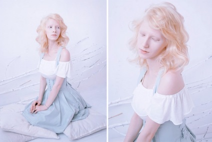 20 Szomorú albínó emberek, amelyek megjelenésüket feltűnőek, umkra