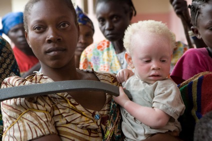 Az afrikai vadászat az albínóknak - az ember rejtélyei - hírek