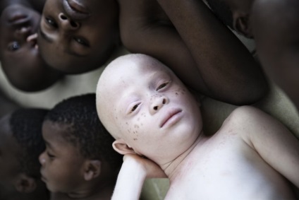 Africa de vânătoare pentru albinos - ghicitori omului - știri