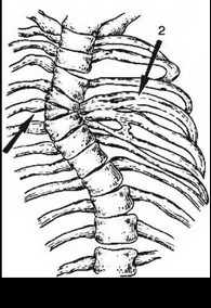 Anomalii în dezvoltarea coastelor, sternului și toracelui în ansamblu