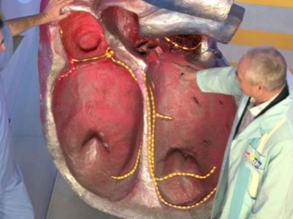 Stenoza aortică a inimii, medicină populară