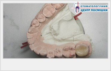 Biomecanica maxilarului inferior
