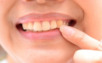 Ce este dentina dintelui, vitaportal - sănătatea și medicina