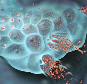 Ami rákos sejteket öl meg, a sugárzás hatása, onkostatus