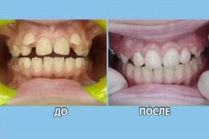 Ortodont pentru copii