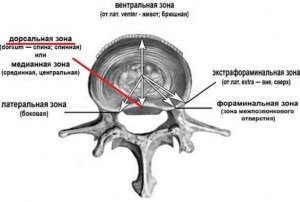 Hernia dorsală a cauzelor discului cervical, simptomele și tratamentul
