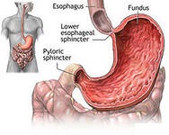 Gastroptosis tratamentul gastroptozei folclorice remedii și metode