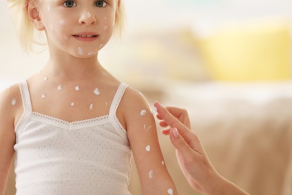 Cum de a scapa de mâncărime de la țânțari și de produse de medicamente pentru copii pentru copii