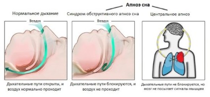 Tratamentul urechii, gâtului și nasului cu ajutorul aparatelor denas