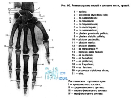 Mecanismele dislocării încheieturii mâinii