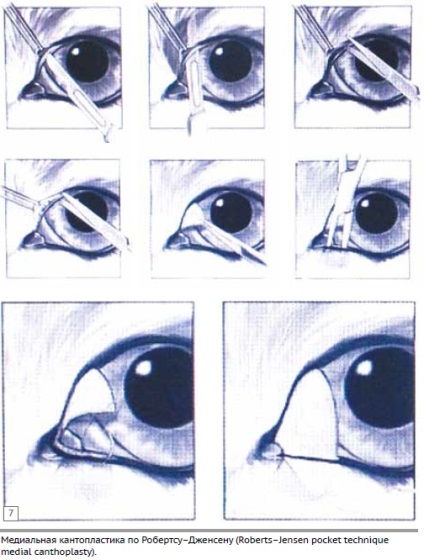 Experiență în aplicarea cantoplastiei medii modernizate în sindromul ocular brachycephalic
