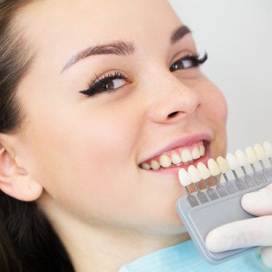Albirea dintilor din Kazan - albire profesionala la dentist - preturi, comentarii