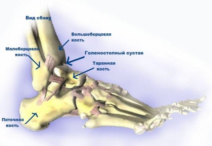 Fractura gleznei