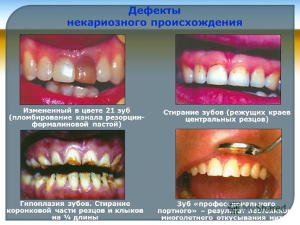 Prezentare pe tema departamentului de stomatologie propaedeutică mgmsu șef de departament d