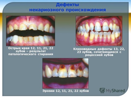 Prezentare pe tema departamentului de stomatologie propaedeutică mgmsu șef de departament d