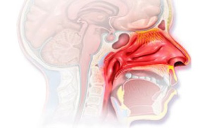 Cauzele congestiei nazale fără metode de tratament reci