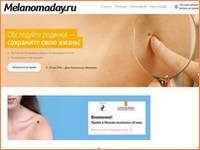 Site-ul zilei de diagnosticare a melanomului în Rusia