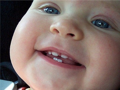 Câți dinți de copil ar trebui să aibă un copil o normă și o abatere