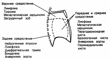 Schema structurii inimii umane