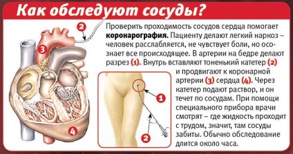 A vazospasztikus angina a betegség ritka formája