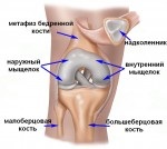 Dislocarea simptomelor de șold de col uterin, cauze, tratament, predicții