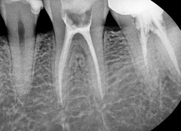 Dental Imaging A Humanra hd 1000 az Ön pótolhatatlan segítője