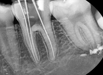 Imagistica dentară Humanra hd 1000 este ajutorul tău neînlocuit