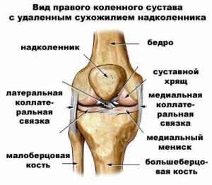 Fracturi intraarticulare ale articulației genunchiului