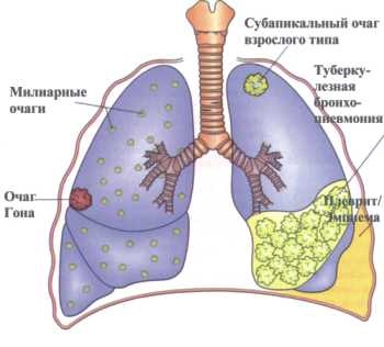 Doctor-pulmonolog în Rostov-on-Don - recepție consultativă