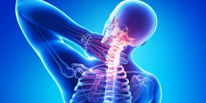 Obstrucția și simptomele de osteochondroză cervicală, cefalee atunci când se dezvoltă