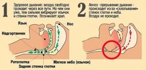 Sforăitul pe abdomen reprezintă un pericol și o cale de ieșire din acesta