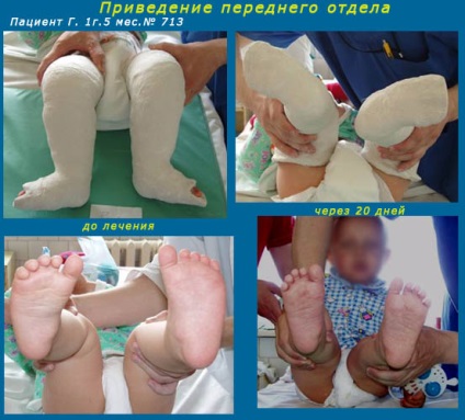 Filiala Yaroslavl a Societății ruse de Chirurgie Picior și Gleznă