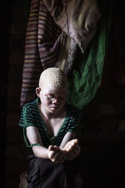 Afrikában a félelmetes valóságot azért ölték meg, hogy amuletteket készítsen belőle