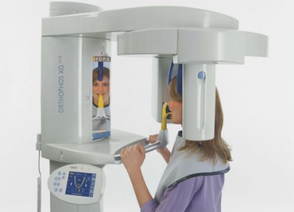 Dental X-ray din 3D și care sunt avantajele diagnosticării 3D