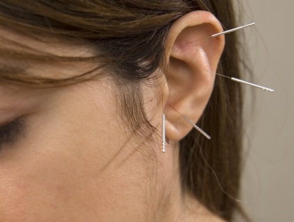 Punctele de acupunctură pe urechi