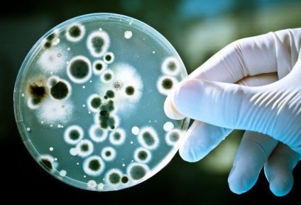 Caracteristica îngrășământului bacterian, aplicație