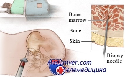 Studii histologice în hematologie