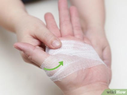 Cum să bandați palma mâinii